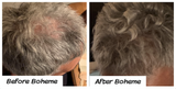 Boheme Hair Growth Supplement (3)