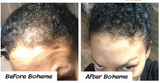Boheme Hair Growth Supplement