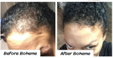 Boheme Hair Growth Supplement (3)